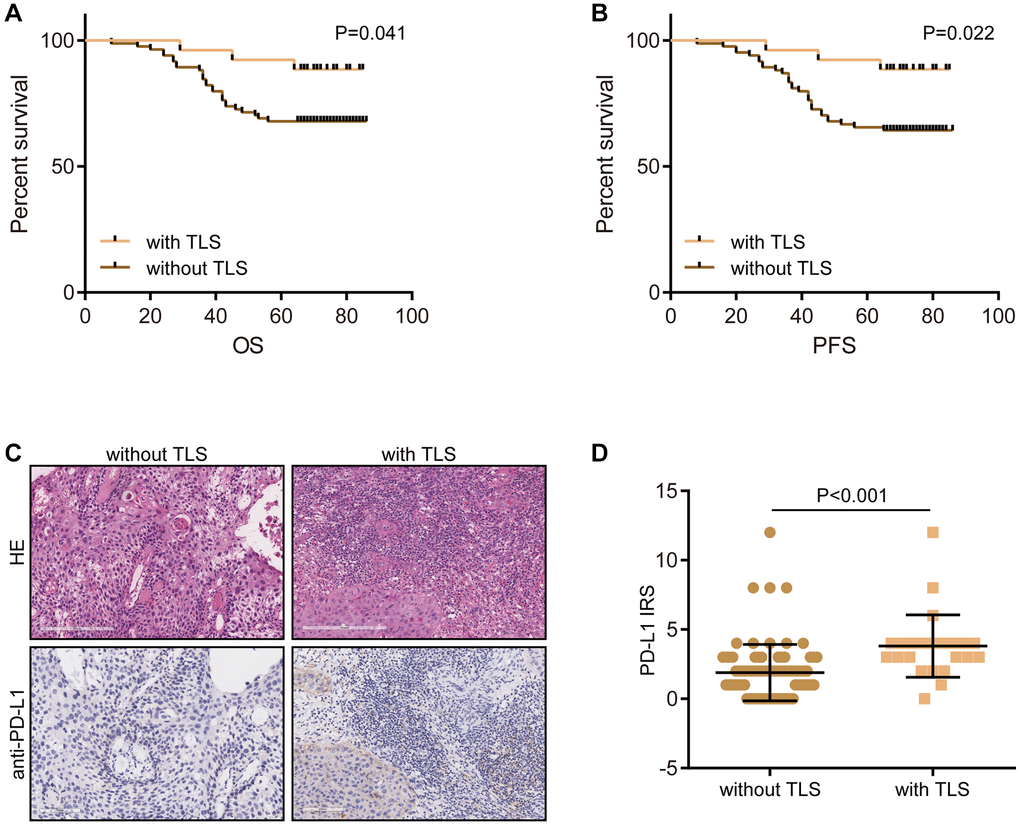 Validation of the prognostic value of TLS and its association with TME features. (A) The prognostic value of TLS in CESC in the term of OS. (B) The prognostic value of TLS in CESC in the term of PFS. (C, D) Representative images revealing PD-L1 expression in CESC samples with or without TLS and semi-quantitative analysis.