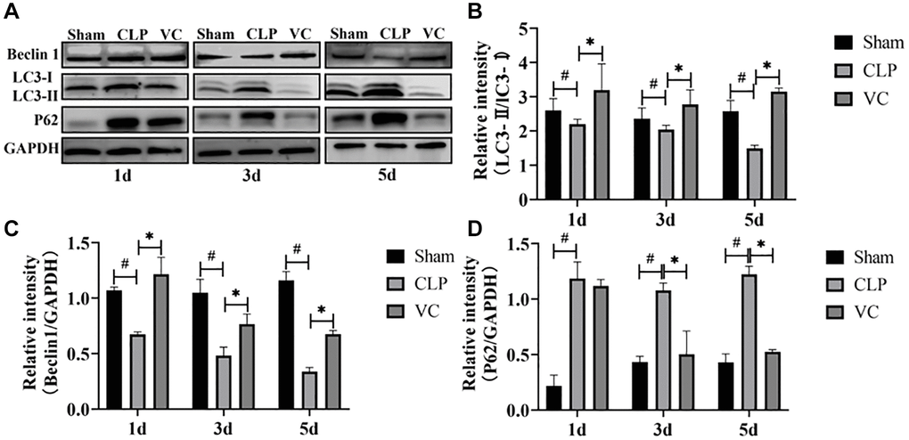 High-dose VC enhanced the cardiomyocyte autophagy in CLP-induced sepsis rats at 1d, 3d and 5d. (A–D) Representative images of LC3-II/LC3-I ratio and the expression of the proteins Beclin-1 and P62 were examined by western blot and the fold activation data analysis. Data are expressed as mean ± SD (at least n = 6/group), #p *p 