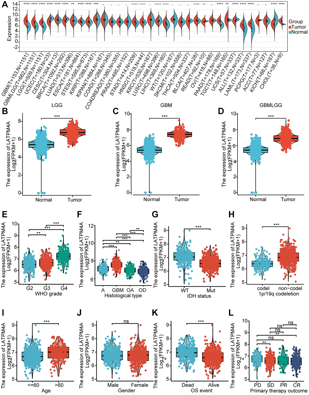 Expression of LAPTM4A in glioma. (A) The expression level of LAPTM4A in different types of tumor tissues and normal tissues in the TIMER database. (p B–D) Expression levels of LAPTM4A were higher than corresponding normal tissues in LGG, GBM, and GBMLGG samples. The box plot showed the association of LAPTM4A expression with clinicopathological characteristics. (E) WHO grade, (F) Histological type, (G) IDH status, (H) 1p/19q codeletion, (I) Age, (J) Gender, (K) OS event, (L) Primary therapy outcome.