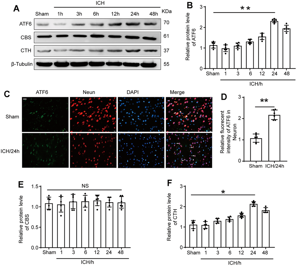 The protein level of ATF6 in neuron increased significantly at 24 h after ICH. (A, B) Western blot analysis and quantification of ATF6 at 1h, 3h, 6h, 12h, 24h and 48h after ICH. (C, D) Double immunofluorescence analysis of ATF6 (green) and neuron (red) in brain sections. Nuclei were labeled with DAPI (blue). Arrow indicated ATF6 positive cells. Scale bar = 50 μm. (E, F) Western blot analysis quantification of CBS and CTH at 1h, 3h, 6h, 12h, 24h and 48h after ICH. The black dots represent individual data in each group. **p p 