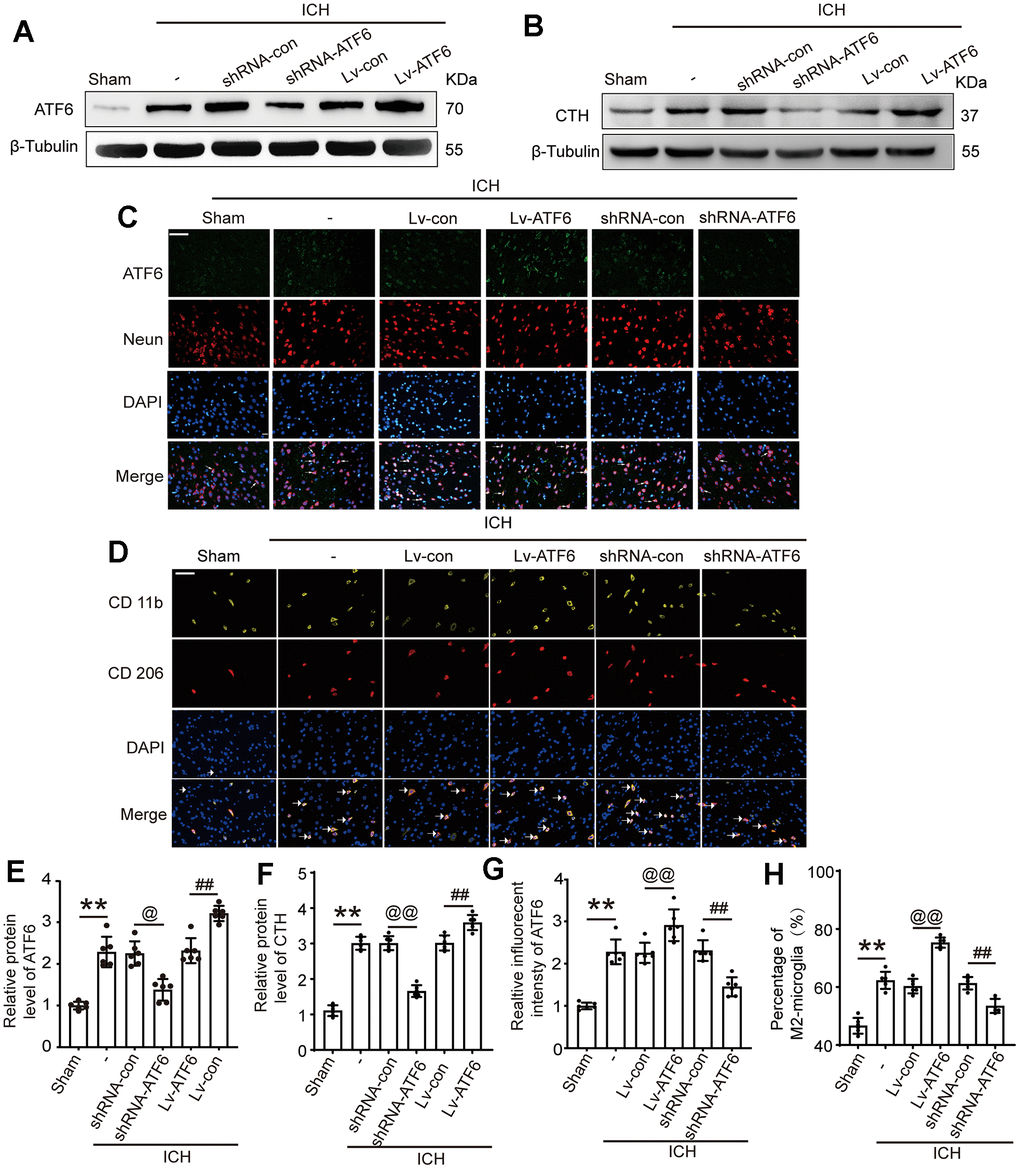 Intervention efficiency of overexpression and interfering RNA lentivirus on ATF6. (A) Representative Western blot image of ATF6 in intervention groups. (B) Representative Western blot image of CTH in intervention groups. (C) Double immunofluorescence analysis of ATF6 (green) and Neuron (red) in brain, arrow indicated ATF6 positive cells. Nuclei were labeled with DAPI (blue). (D) Double immunofluorescence analysis of microglia (yellow) and M2-microglia (red) in brain, arrow indicated M2-microglia positive cells. (E) Western blot analysis quantification of ATF6 in intervention groups. (F) Western blot analysis and quantification of CTH in intervention groups. (G) The relative fluorescent intensity of ATF6 in neuron cells. (H) The percentage of M2-positive microglia was analyzed. Scale bar = 50 μm. The black dots represent individual data in each group. **p p @@p @p ##p #p 