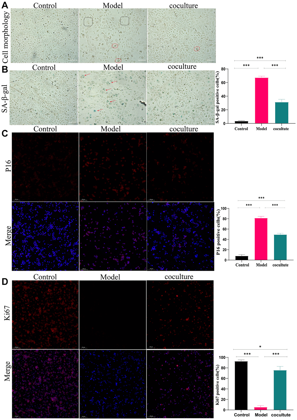 Interference effect of UCMSCs on senescent TECs in vitro. (A) The morphology of TECs (100×). (B) The activity of β-galactosidase was determined using β-galactosidase staining (100×). (C) P16 expression was detected by immunocytochemical staining (100×). (D) Ki67 staining was performed to observe TEC proliferation (100×) (the measured values represent the mean ± standard deviation (X ± s)) of three replicate experiments. *P **P ***P 