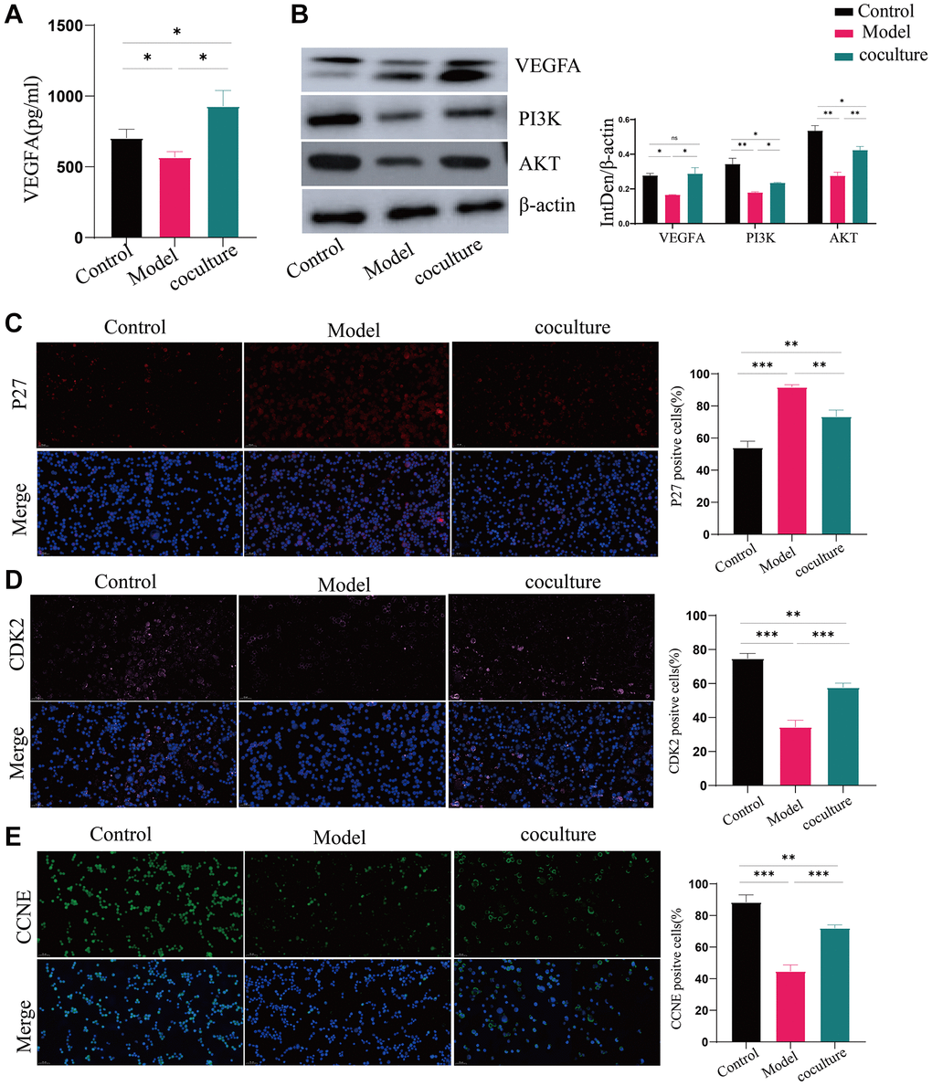 UCMSCs boost the activity of the PI3K-AKT pathway in senescent TECs. (A) VEGFA expression was detected by ELISA. (B) The PI3K-AKT signaling pathway proteins VEGFA, PI3K, and AKT were shown to be expressed by western blotting, with β-actin serving as a control. (C–E) After the PI3K-AKT signaling pathway, immunofluorescence was used to measure the levels of p27, CDK2, and CCNE, which are important for cell cycle regulation (100×). The measured values represent the mean ± standard deviation (X ± s) of three replicate experiments. *P **P ***P 