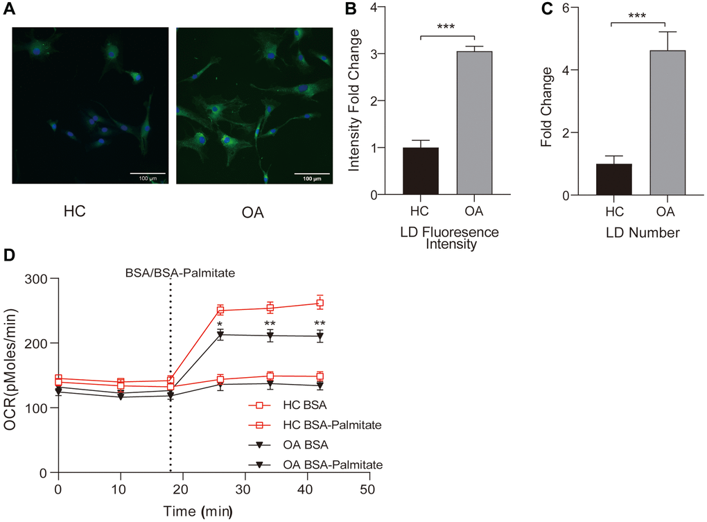 The changes in intracellular lipid metabolism in OA. (A) Representative images of intracellular lipid droplets stained with BODIPY 493/503. The left side shows normal chondrocytes, and the right side shows OA chondrocytes; Scale bar: 100 μm. (B) Multiplicative changes in the average fluorescence intensity of intracellular lipid droplets stained with BODIPY 493/503. (C) Multiplicative changes in the number of lipid droplets stained with BODIPY 493/503. (D) Measurement of changes in fatty acid oxidation (FAO) in cells from the Normal and OA groups. Dashed lines represent the time points of adding BSA (0.17 mM) or BSA-Palmitate ester (1 mM). *p **p ***p 