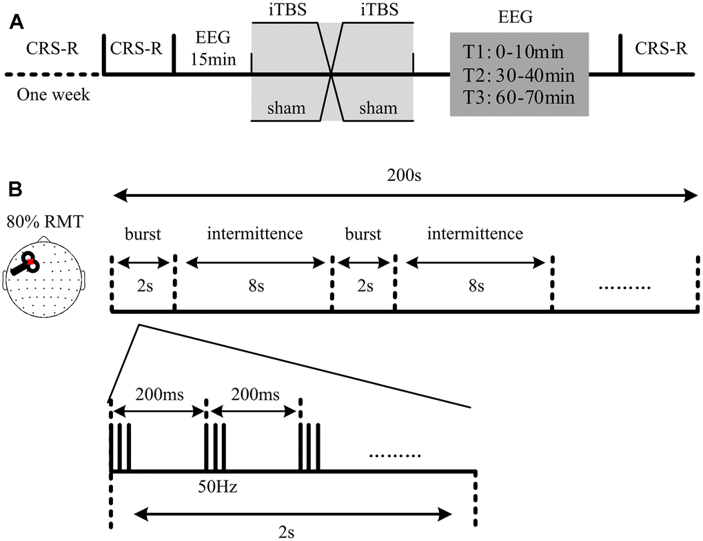 Protocol of the experiment. (A) Structure of the sham-controlled, cross-over study. Each patient received two randomized sessions of stimulation (a real and a sham session). The real and sham sessions had at least a three-day washout period in between. The Coma Recovery Scale-Revised (CRS-R) assessment and fifteen minutes of electroencephalography (EEG) recording were conducted at the beginning of each session. 70 minutes of EEG recording, followed by another CRS-R assessment, was recorded immediately after each stimulation. T1, T2 and T3 refer to the EEG recording at 0-10 min, 30-40 min and 60-70 min, respectively. (B) Intermittent theta burst stimulation (iTBS) setup used in the study. Each stimulation included 600 stimuli: 20 trains of 50Hz bursts (3 pulses) repeated at 5Hz.