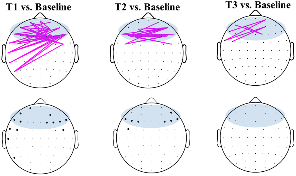 Weighted phase lag index (wPLI) of pairwise electrodes in the baseline and post-stimulation of the real stimulation. Pink lines show significantly (p