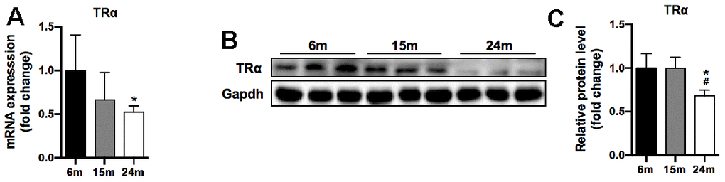 TRα mRNA and protein levels of SM in mice during aging. (A) mRNA level of TRα, n=7; (B) Representative Western blots and (C) quantification of TRα and Gapdh (loading control), n=3. *p