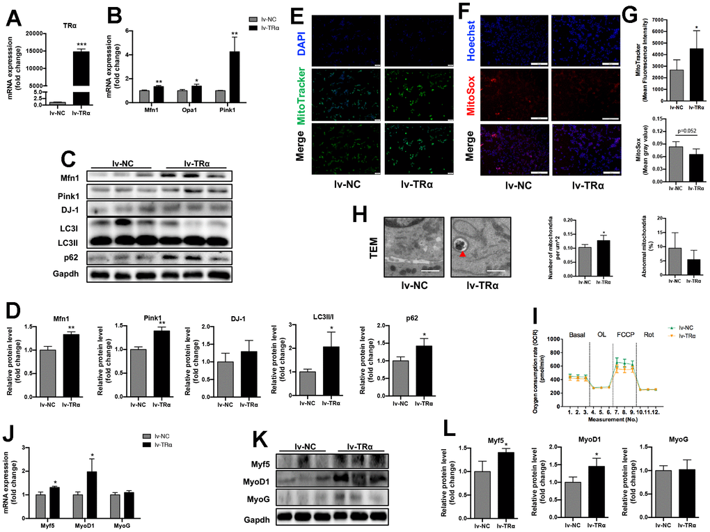 Overexpression of TRα in C2C12. Cells were transfected with TRα-targeted overexpression plasmid or non-targeted plasmid for 24h, 48h or 72h. lv-NC negative control, lv-TRα overexpressing plasmid-vector TRα. (A) mRNA level of TRα, n=3; (B) mRNA levels of Mfn1, Opa1 and Pink1, n=3; (C) Representative Western blots and (D) quantification of Mfn1, Pink1, DJ-1, LC3II/I, p62 and Gapdh (loading control), n=3; (E) Representative MitoTracker immunofluorescence staining of cells, nuclei were counterstained with DAPI, scale bar: 100 μm; (F) Representative MitoSox immunofluorescence staining of cells, nuclei were counterstained with Hoechst, scale bar: 200 μm; (G) Quantification of MitoTracker Green fluorescence intensity (n=8) and MitoSox Red fluorescence intensity (n=5), respectively, fluorescence intensity was quantified using densitometric image analysis software with cell quantity adjustment; (H) Representative transmission electron microscopy images of mitochondria and quantification of mitochondrial number and percentage of abnormal mitochondria, the red ‘▲’ is labeling mitochondria inside autophagic vesicles, Scale bar: 1 μm, n=5; (I) Seahorse analysis of oxygen consumption rate (OCR), OCR was measured continuously throughout the experimental period at baseline and in the presence of the indicated drugs: 1.5 μM oligomycin, 0.5 μM FCCP and 0.5 μM rotenone, n=4; (J) mRNA levels of Myf5, MyoD1 and MyoG, n=3; (K) Representative Western blots and (L) quantification of Myf5, MyoD1, MyoG and Gapdh (loading control), n=3. *p