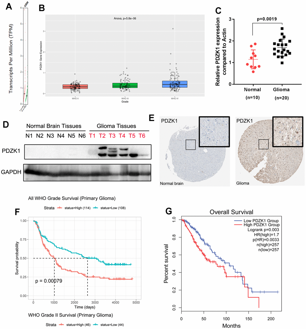 PDZK1 is upregulated in glioma tissues, and high PDZK1 expression is associated with poor prognosis. (A) The PDZK1 expression data in glioma tissues were obtained from TCGA datasets (GEPIA); GBM tissues have a higher PDZK1 expression level than normal tissues. (B) PDZK1 expression data were obtained from CGGA datasets; the PDZK1 expression level was associated with tumor histologic grade. (C) Real-time qPCR was used to detect the mRNA expression of PDZK1 in glioma tissues, and the expression of PDZK1 was much greater in glioma tissues than in normal brain tissues (p=0.0019). (D) Western blotting was used to detect the protein expression of PDZK1 in glioma tissues, and the protein expression of PDZK1 was much greater in glioma tissues than in normal brain tissues. (E) Immunohistochemical staining showed that PDZK1 expression is much greater in glioma tissues than in normal brain tissues, as shown in the image obtained from The Human Protein Atlas. (F, G) Glioma patients with lower PDZK1 expression had a more favorable survival time than did glioma patients with higher PDZK1 expression. The Kaplan–Meier method was used for this analysis. (F) data from CGGA; (G) data from TCGA.