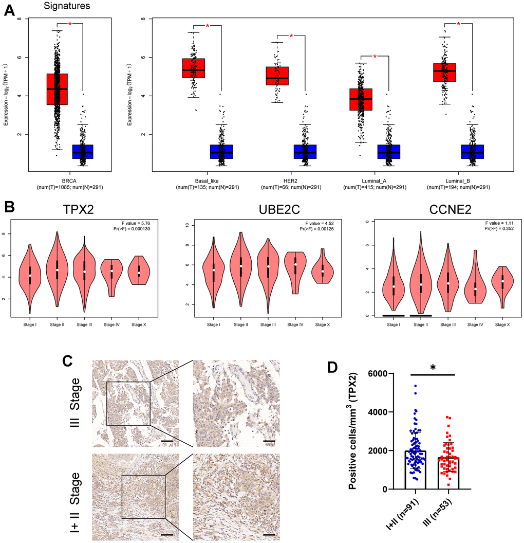 (A) The expression level of these three candidate cell cycle-related DEGs in BC or four BC subtypes (Basal-like; HER2; Luminal-A; Luminal-B) and normal patients. (B) Correlations between TPX2/UBE2C/CCNE2 expression and tumor stage in BRCA patients. PC, D) Immunohistochemistry detecting the protein level of TPX2 in various stages. *P 