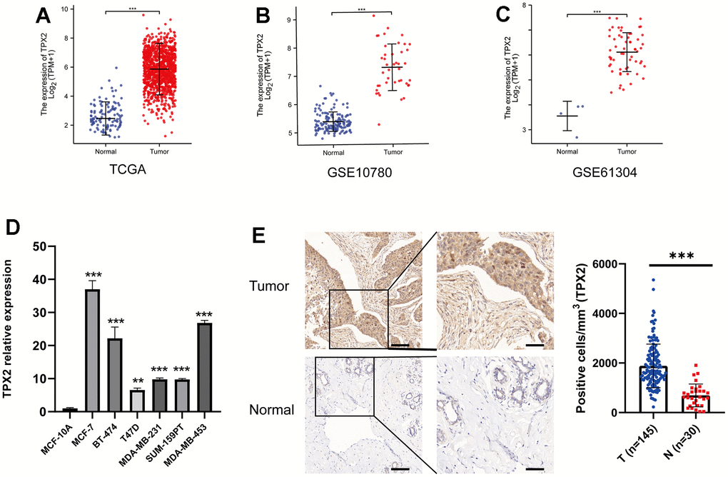 Expression profile and survival situation of TPX2 in BRCA. (A–C) Differential expression levels of TPX2 in BRCA from TCGA and GEO database. (D) The mRNA expression of TPX2 in breast cancer cell lines. (E) The differential protein level of TPX2 in breast tumor and normal tissues. **P 