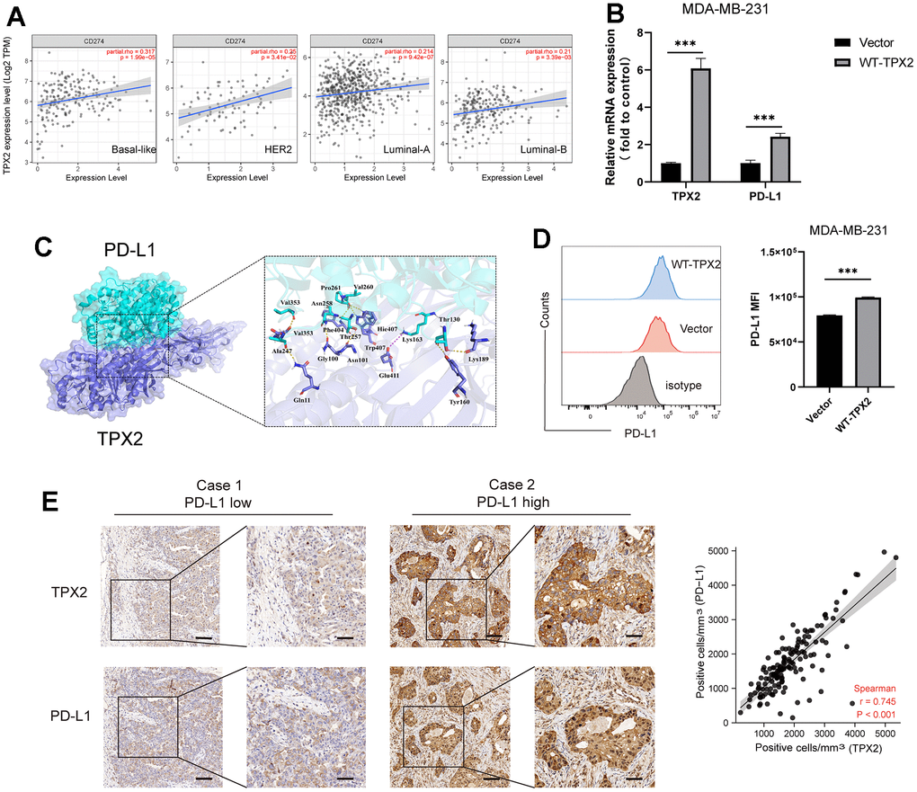 The relationship between TPX2 and PD-L1 in BRCA. (A) TIMER database illustrating the relationship between TPX2 and CD274 (PD-L1) in four BC subtypes. (B) RT-QPCR experiment illustrating the gene relationship between TPX2 and PD-L1. (C) Molecular docking simulating the amino acid interaction between TPX2 and PD-L1. (D) Flow cytometry illustrating the protein relationship between TXP2 and PD-L1. (E) Immunohistochemistry detecting the protein level of TPX2 and PD-L1 from tissue microarray. Scar bar: 100 μm. ***P 