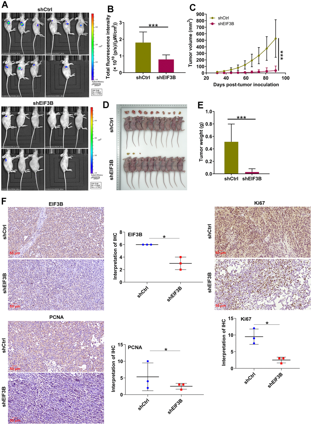 EIF3B knockdown inhibited cholangiocarcinoma tumor growth in vivo. (A) Establishment of animal models by implanting EIF3B-knockdown and control RBE cells into female BALB/c nude mice for investigating the role of EIF3B in cholangiocarcinoma tumor growth. (B) The fluorescence intensity in shCtrl and shEIF3B groups was obtained through injecting D-Luciferase. (C–E) Evaluation of tumor growth parameters in the animal models, including tumor volume (C), size (D), and weight (E). (F) Typical images and quantitative data illustrations of EIF3B, PCNA and Ki67 immunohistochemical staining in mice tumor tissues. Scale bar: 50 μm. Magnification times: 200 ×. Results were presented as mean ± SD. * P P 