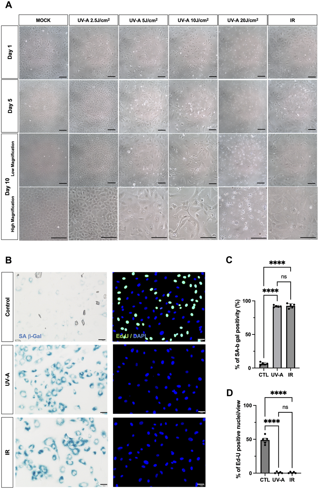 Morphological changes of human corneal endothelial cells after UV-A exposition. (A) Representative images of human corneal endothelial cells 1 (top), 5 (middle-upper) and 10 days (middle-lower: low magnification) (bottom: high magnification) after UV-A or IR treatment. Cells were either mock-treated or treated with four doses of UV-A (2.5, 5, 10, and 20 J/cm2) or IR (10 Gy). Scale bar: 100μm. (B) SA-β-Gal staining (left panels) and EdU labeling (right panels) of human corneal endothelial cells (hCEnCs). Cells were treated or not with 5 J/cm2 UV-A or 10 Gy IR, cultured for 10 days, and then SA-β-Gal staining and EdU labeling performed. Representative images are shown. Scale bar: 100μm. (C) quantification of SA-β-Gal staining, and (D) quantification of EdU labeling, plotted as mean of % of positive cells from five independent experiments.