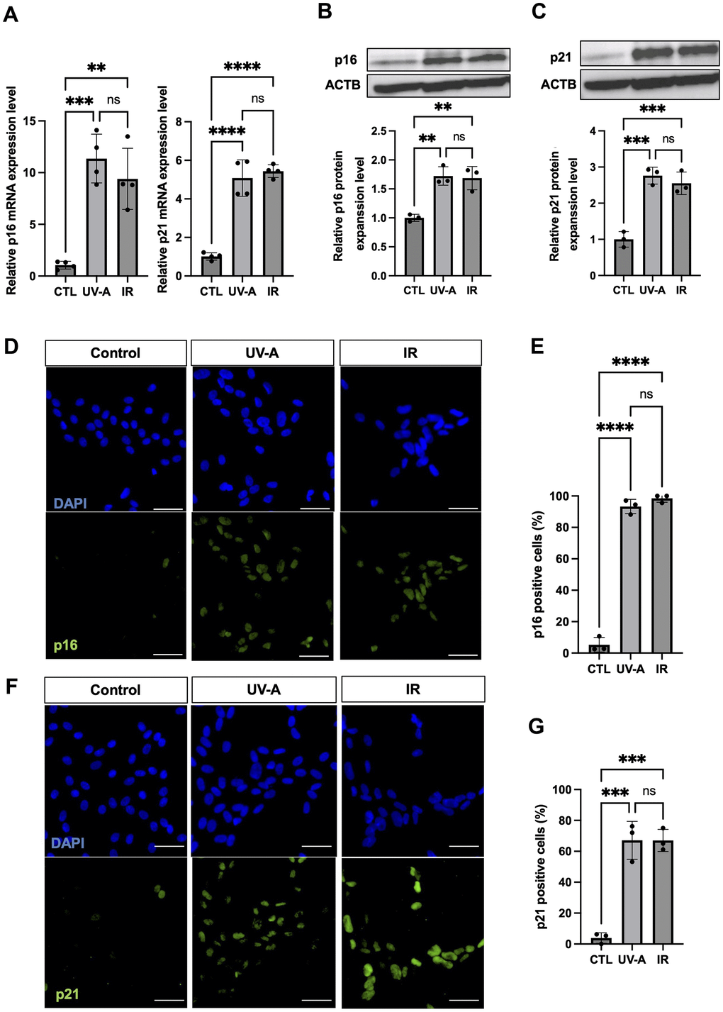 Characteristics of senescent human corneal endothelial cells. (A) RNA expression analysis by real-time PCR of p16 and p21 in control, UV-A-treated or IR-treated cells from four independent experiments. Gene expression was normalized to the housekeeping gene ACTB. B-C, Protein expression analysis by western blotting and quantification of p16 (B) and p21 (C) in control, UV-A-treated or IR-treated cells from four independent experiments. Results were plotted as mean and standard deviation from three independent experiments. Gene expression was normalized to the housekeeping protein ACTB. D-G, Immunofluorescent staining (D) and quantification (E) of p16 protein expression, and immunofluorescent staining (F) and quantification (G) of p21 protein expression, in hCEnCs treated upon UV-A or IR. Representative images are shown with scale bars indicating 100 μm. Quantification of immunofluorescent staining is presented as the mean percentage of positive cells from three independent experiments. ** = p 