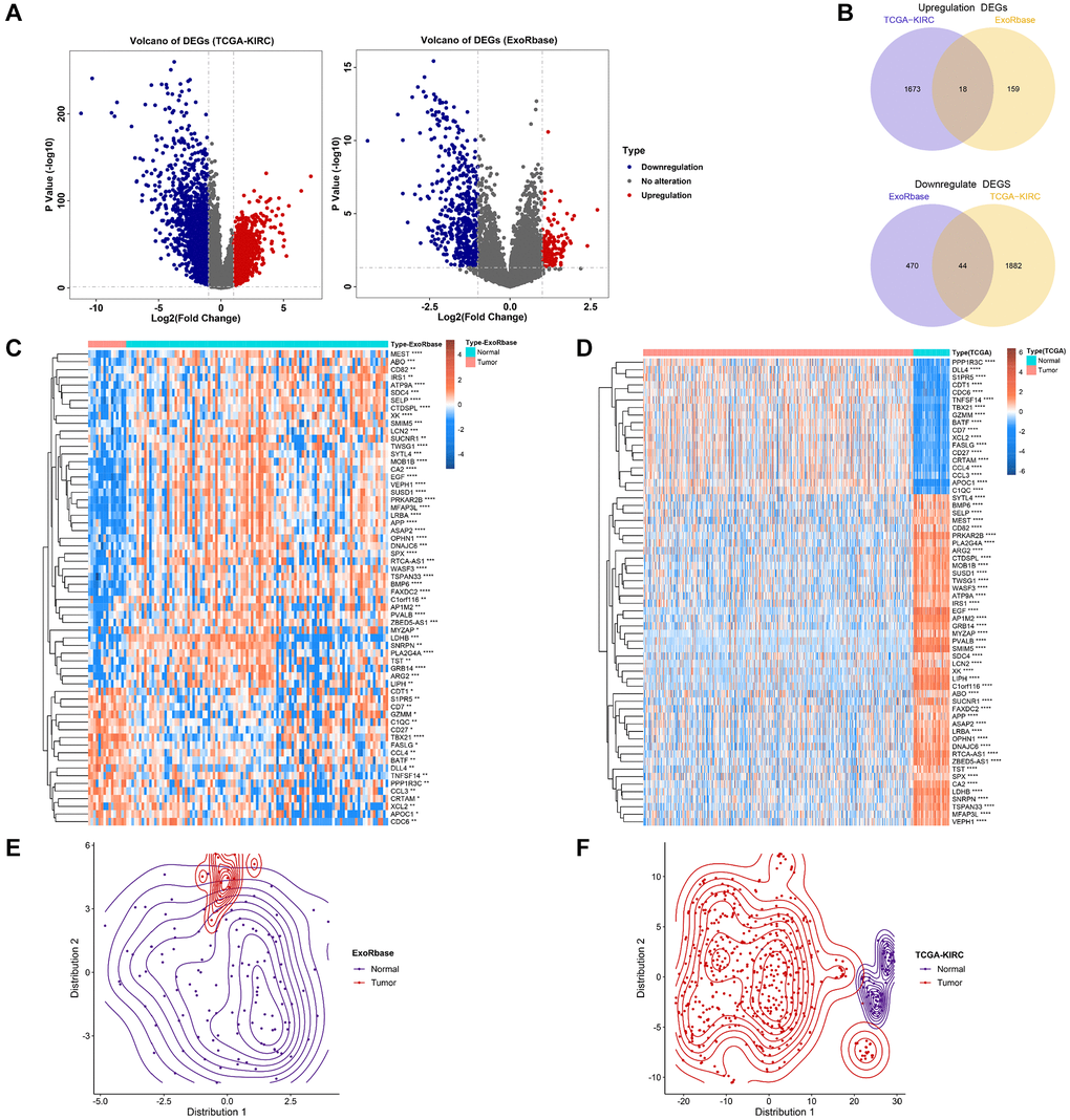 Identification of exosome-related genes in KIRC. (A) The volcano figure shows the differentially expressed genes between KIRC and normal control in exoRBase and TCGA-KIRC datasets. (B) The Venn diagram shows the common up-regulated genes and down-regulated genes in exoRBase and TCGA-KIRC datasets. (C, D) Heatmaps show the expression levels of ERGs in tumours and normal tissues. (E, F) T-SNE analyses were performed to show the distribution of tumour tissues and normal tissues based on ERG expression.