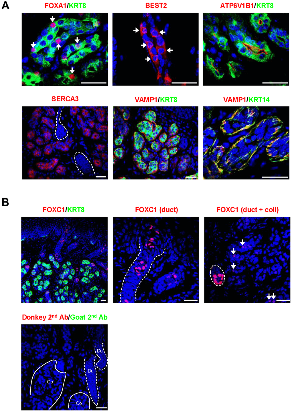 Localization of core secretory proteins in SWGs. (A) Localization of FOXA1 and BEST2 in scattered secretory cells (arrows), ATP6V1B1 in luminal cell membrane in the secretory coil, SERCA3 in the cytoplasm of secretory cells (but not sweat duct, demarcated by broken lines), and VAMP1 protein surrounding KRT8+ secretory cells and co-localizing with the myoepithelial cell marker KRT14. (B) Top, expression of FOXC1 in sweat duct cells (left); higher magnification shows localization of FOXC1 in epidermal and dermal duct luminal cells (middle). FOXC1 protein is expressed in secretory cells (arrows, right), but expression signals are stronger in duct cells (dotted circle). Bottom, negative control staining (secondary antibodies). Scale bars, 25 μm. Data are representative of two to four biological replicates.