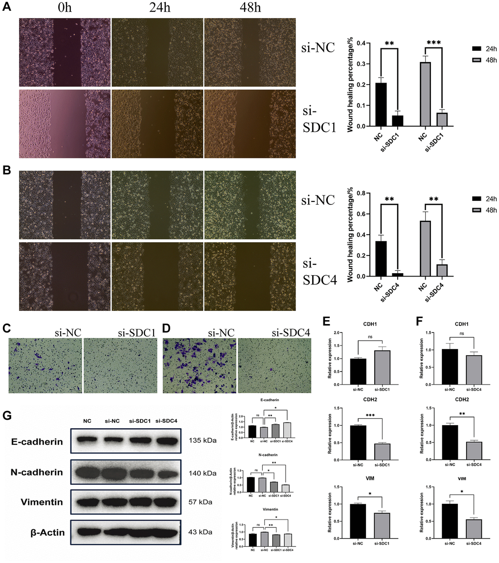 In vitro experimental results. (A) Evaluation of scratch tests conducted at 24 h and 48 h following SDC1 knockdown, relative to the negative control group, with subsequent determination of wound healing percentage. (B) Assessment of scratch tests performed at 24 h and 48 h following SDC4 knockdown, relative to the negative control group, with subsequent determination of wound healing percentage. (C) Analysis of Transwell migration experiments following SDC1 knockdown, relative to the negative control group. (D) Examination of Transwell migration experiments following SDC4 knockdown, relative to the negative control group. (E) Contrasting the mRNA relative expression levels of CDH1, CDH2, and VIM following SDC1 knockdown with those of the negative control group. (F) Contrasting the mRNA relative expression levels of CDH1, CDH2, and VIM following SDC4 knockdown with those of the negative control group. (G) Contrasting the protein relative expression levels of E-cadherin, N-cadherin, and Vimentin following SDC1 or SDC4 knockdown with those of the negative control group. (*P **P ***P 