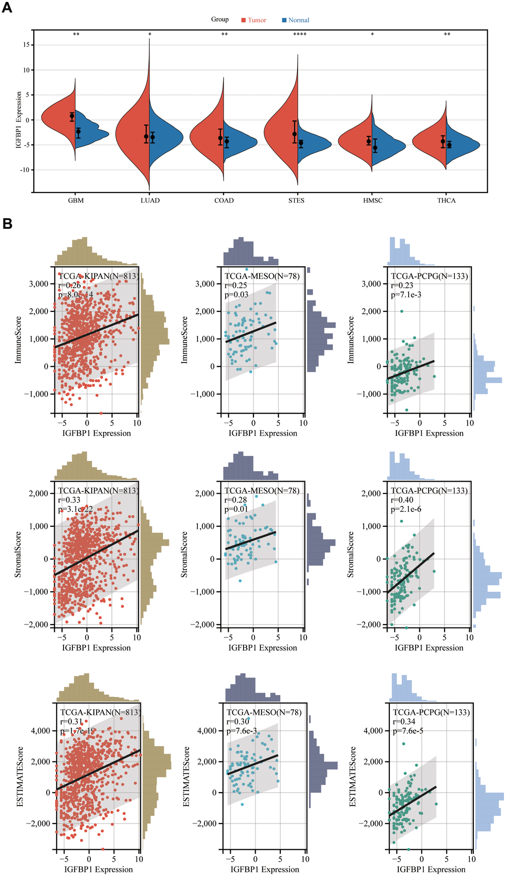 Pan-cancer analysis of IGFBP1. (A) The expression of IGFBP1 was compared between tumor tissue and normal tissue in other different types of cancer. (B) Association of IGFBP1 expression and immune score, stromal score or tumor purity was evaluated using ESTIMATE analysis. GBM, glioblastoma multiforme; LUAD, lung adenocarcinoma; COAD, colon adenocarcinoma; STES, stomach and esophageal carcinoma; HNSC, head and neck squamous cell carcinoma; THCA, thyroid carcinoma; KIPAN, pan-kidney carcinoma; MESO, mesothelioma; PCPG, pheochromocytoma and paraganglioma. *P 