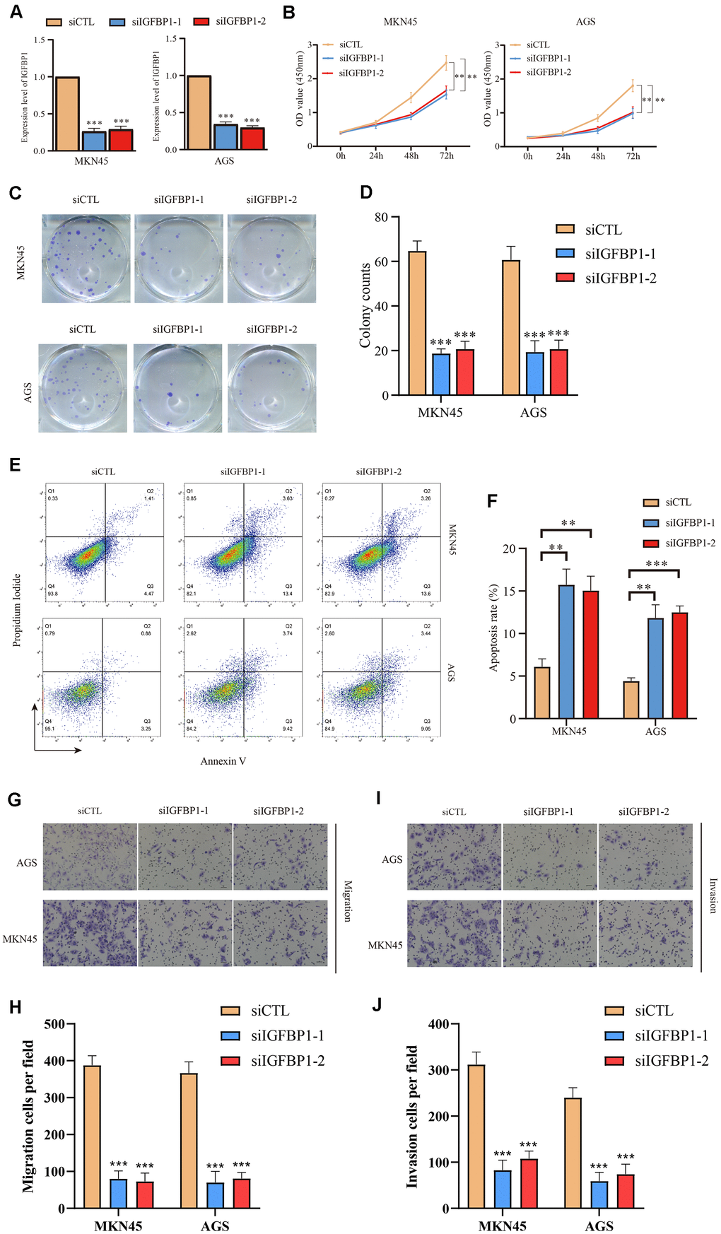 Functional validation of IGFBP1 in AGS and MKN45 cell lines. (A) The knockdown efficiency of IGFBP1 was tested by qPCR in MKN45 and AGS cell lines. (B) The proliferation efficiency of MKN45 and AGS cell lines with IGFBP1 knockdown by CCK8 assay. (C) The proliferation efficiency of MKN45 and AGS cell lines with IGFBP1 knockdown by cell cloning formation. (D) The statistical analysis of (C). (E) The apoptosis of MKN45 and AGS cell lines with IGFBP1 knockdown. (F) The statistical analysis of (E). (G) The migration efficiency of MKN45 and AGS cell lines with IGFBP1 knockdown. (H) The statistical analysis of (G). (I) The invasion efficiency of MKN45 and AGS cell lines with IGFBP1 knockdown. (J) The statistical analysis of (I).