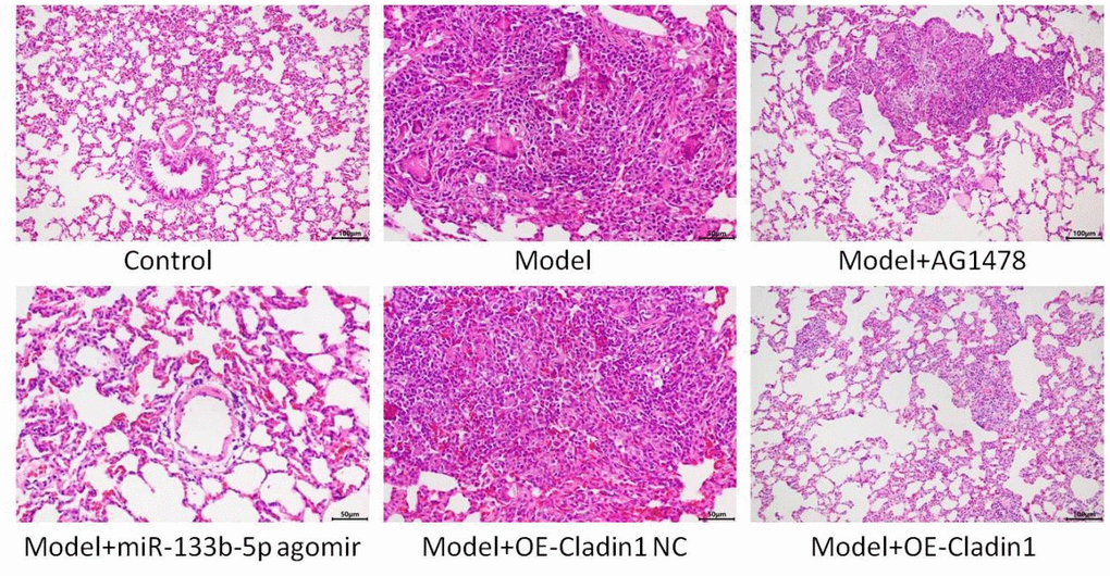 HE staining to observe the lung tissue of rats in each group.