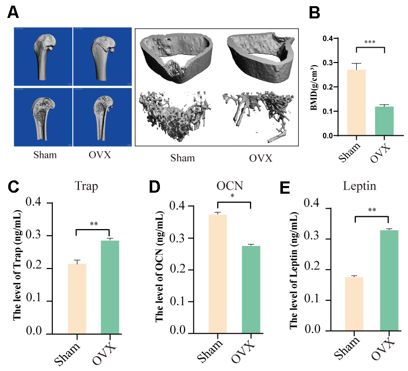 The effects of ovariectomy on bone formation and Leptin levels in OVX SD rats. (A) Micro-CT scanning results of femurs from the OVX and sham SD rats. (B) Quantitative analysis of bone parameters. Bone mineral density (BMD). (C–E) ELISA assay results show the levels of Trap, OCN, and Leptin in the serum of OVX and sham rats. (“*” PP 