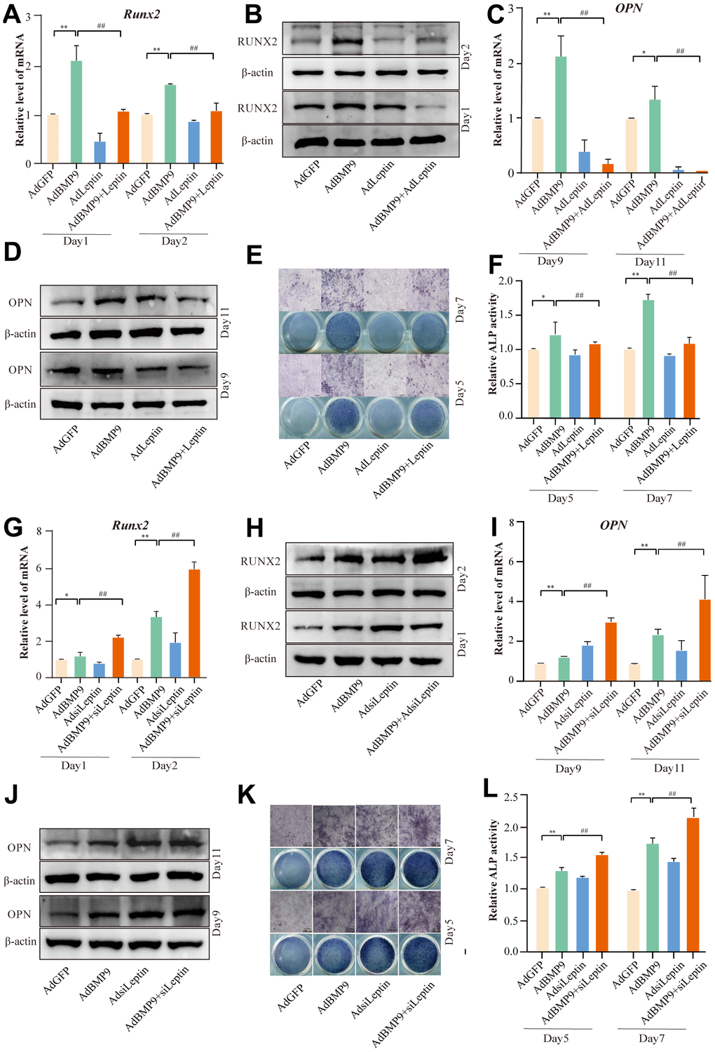 The effects of Leptin on BMP9-induced osteogenic markers in C3H10T1/2 cells. (A–D) qPCR and Western blot assay shows the effect of overexpressing Leptin on Runx2 and OPN. (E) ALP staining shows the effect of overexpressing Leptin on ALP activity. (F) Quantitative result of ALP staining. (G–J) qPCR and Western blot assay show the effect of silencing Leptin on Runx2 and OPN. (K) ALP staining shows the effect of silencing Leptin on ALP activity. (L) Quantitative results of ALP staining. The scale bar is 200 μm. (“*” P PPP 