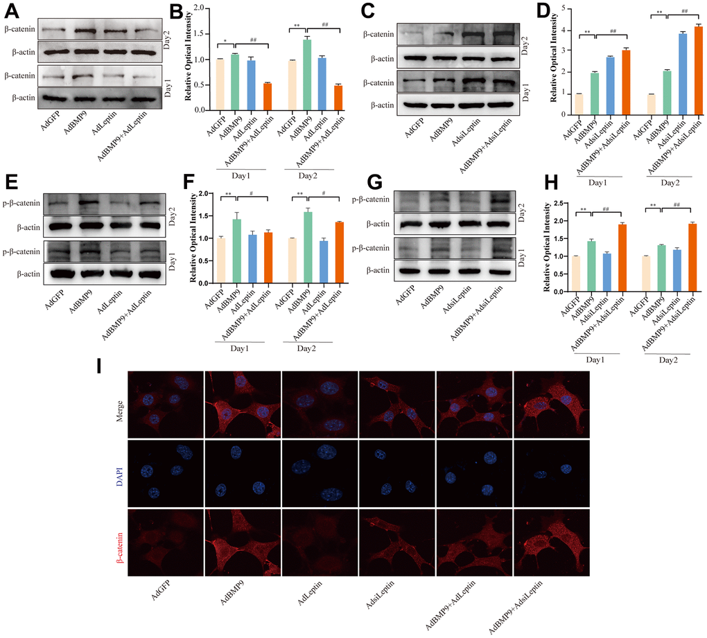 The effects of BMP9 and/or Leptin on Wnt/β-catenin in C3H10T1/2 cells. (A) Western blot assay shows the effect of overexpressing Leptin on β-catenin. (B) Semi-quantification of the level of β-catenin. (C) Western blot assay shows the effect of knocking down Leptin on β-catenin. (D) Semi-quantification of the level of β-catenin. (E) Western blot assay shows the effect of overexpressing Leptin on phosphorylated β-catenin. (F) Semi-quantification of the level of phosphorylated β-catenin. (G) Western blot assay shows the effect of knocking down Leptin on phosphorylated β-catenin. (H) Semi-quantification of the level of phosphorylated β-catenin. (I) Confocal assay shows the effect of Leptin on β-catenin. (“*” P P PP 