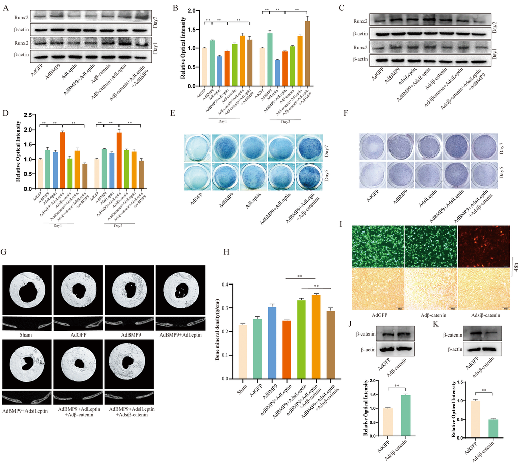 The effects of Leptin and/or β-catenin on BMP9-induced osteogenic markers and bone defect repair. (A) Western blot assay shows the effect of overexpressing Leptin and/or β-catenin on Runx2. (B) Semi-quantification of the level of Runx2. (C) Western blot assay shows the effect of knocking down Leptin and/or β-catenin on Runx2. (D) Semi-quantification of the level of Runx2. (E) ALP staining shows the effect of overexpressing Leptin and/or β-catenin effect on ALP activities. (F) ALP staining shows the effect of knocking down Leptin and/or β-catenin on ALP activities. (G) The 3D reconstruction of μ-CT scanning data shows the effect of β-catenin and/or Leptin on BMP9-induced bone repair (representative data are shown). (H) Quantitative analysis of μ-CT scanning (bone mineral density). (I) Images show the infection efficiency of AdGFP, Adβ-catenin, and Adsiβ-catenin in C3H10T1/2 cells (48 h). (J, K) Western blot assays show the effect of recombinant adenovirus on β-catenin in C3H10T1/2 cells (48 h). The scale bar is 200 μm. (“*” P P P P 