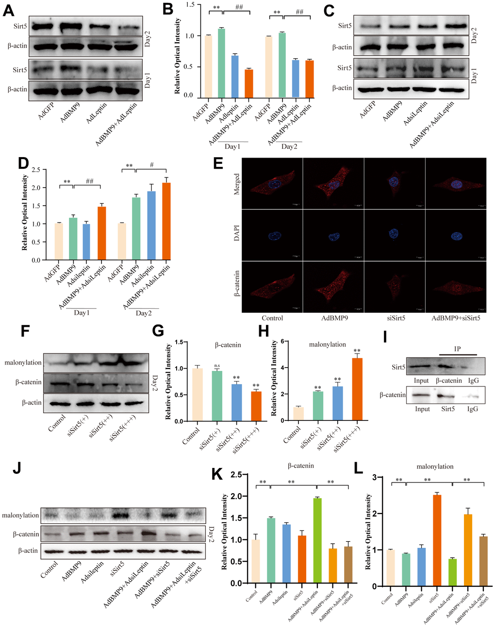 The effects of Sirt5 on Leptin-induced malonyl modification of β-catenin. (A) Western blot assay shows the effect of overexpressing Leptin on Sirt5. (B) Semi-quantification of the level of Sirt5. (C) Western blot assay shows the effect of knocking down Leptin on Sirt5. (D) Semi-quantification of the level of Sirt5. (E) Confocal assay shows the effect of knocking down Sirt5 on β-catenin. (F) Western blot assay shows the effect of knocking down Sirt5 on the level of lysine malonylation and β-catenin. (G, H) Semi-quantification of the level of β-catenin or malonylation. (I) IP assay shows the possible interaction between Sirt5 and β-catenin. (J) Western blot assay shows the effect of knocking down Sirt5 and/or Leptin on β-catenin and malonylation modification. (K, L) Semi-quantification of the level of β-catenin or malonylation. (“*” P P P P 