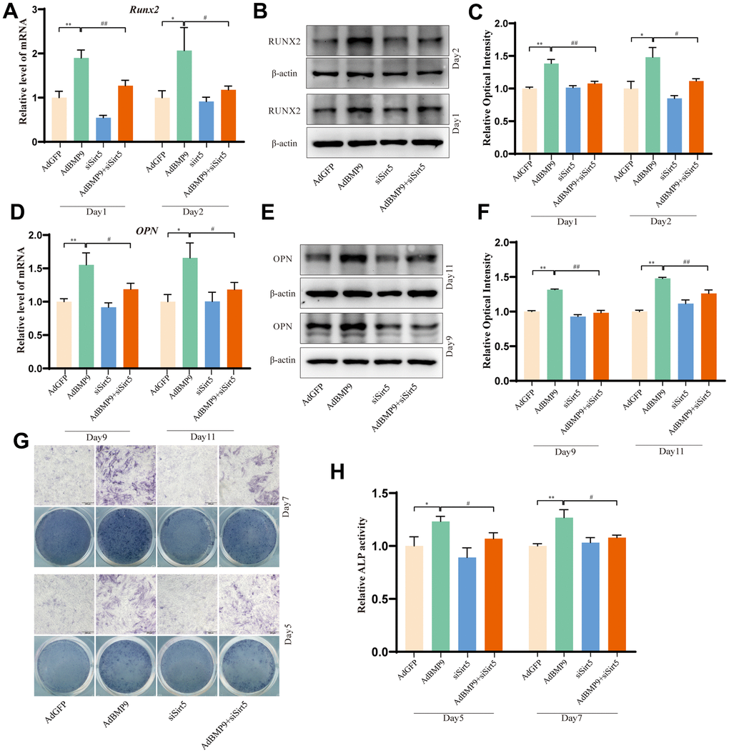 The effects of Sirt5 on BMP9-induced osteogenic markers in C3H10T1/2 cells. (A, B) qPCR and Western blot assay show the effect of knocking down Sirt5 on Runx2. (C) Quantification of the Western blot assay. (D, E) qPCR and Western blot assay show the effect of knocking down Sirt5 on OPN. (F) Quantification of the Western blot assay. (G) ALP staining shows the effect of knocking down Sirt5 on ALP activity. (H) Quantitative results of ALP staining. (“*” P PPP 