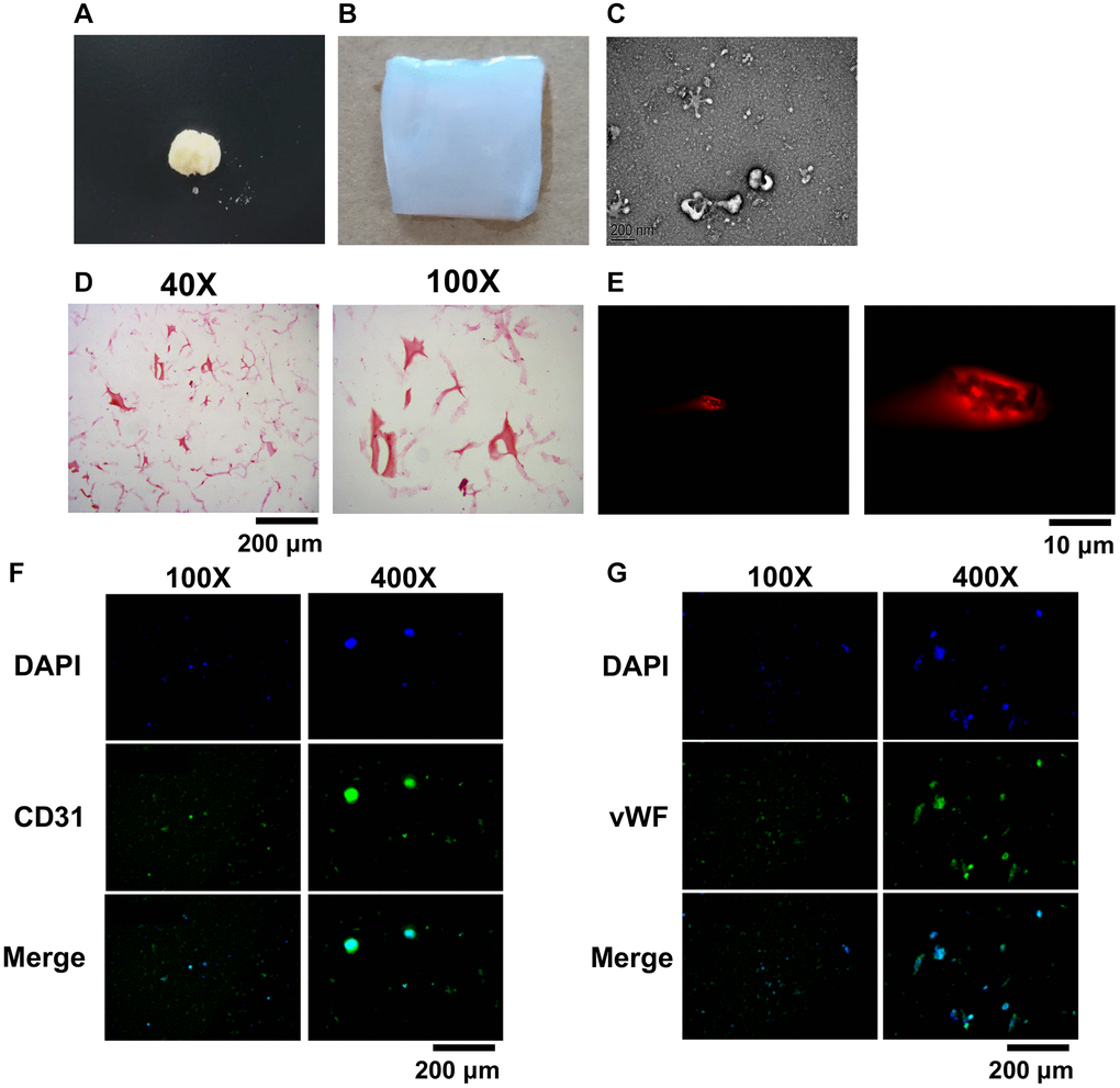 Preparation and characterization of BMSCs-GSSM-gel. (A) Freeze-dried and crushed skin mucus of salamanders. (B) The BMSCs-GSSM-gel was prepared. (C) Size observation of BMSCs-GSSM-gel with SEM. (D) HE staining was performed to investigate BMSCs-GSSM-gel. (E) Rhodamine staining was performed to investigate BMSCs-GSSM-gel. (F, G) BMSCs differentiation was evaluated by observing CD31 and vWF.