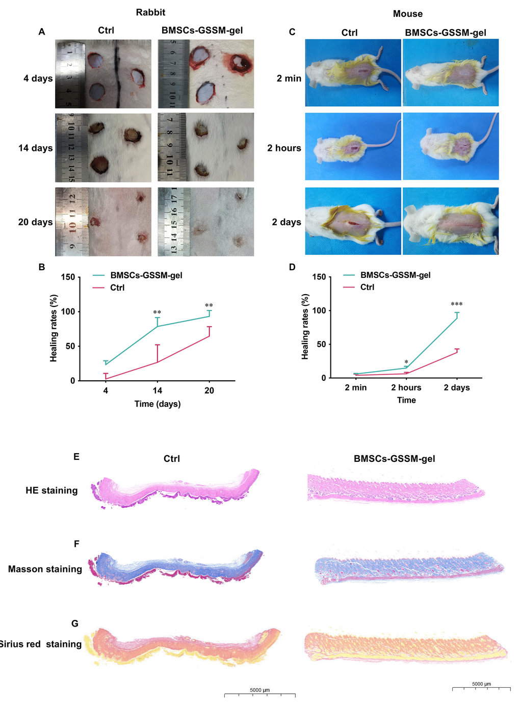 BMSCs-GSSM-gel accelerated wound healing. (A, B) BMSCs-GSSM-gel greatly improved skin wound healing in rabbit model (6 animals in each group). (C, D) BMSCs-GSSM-gel greatly improved skin wound healing in mouse model (9 animals in each group). (E) HE staining was performed to investigate skin histological changes. (F, G) Collagen deposition was evaluated with Masson’s trichrome and Sirius red staining. *p **p ***p 