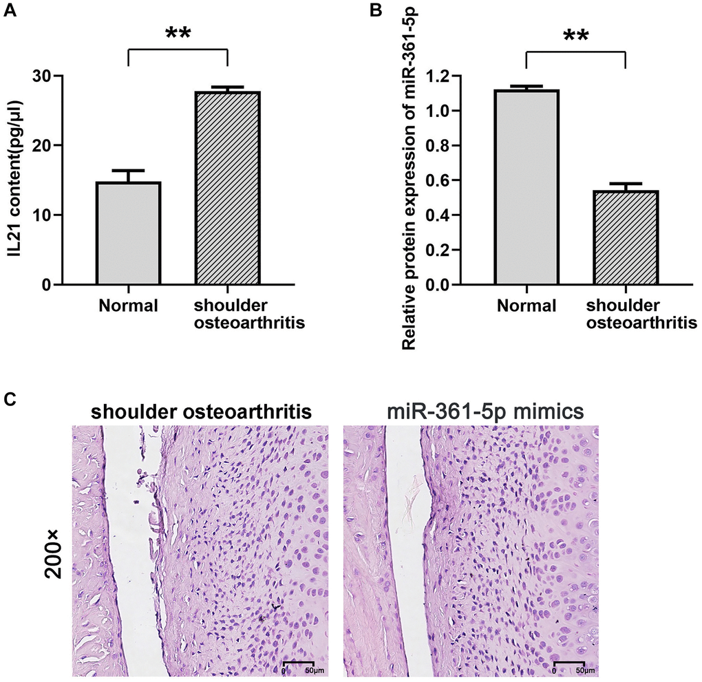 Expression of IL21 and miR-361-5p and their possible relationship. (A, B) ELISA was used to detect the expression of IL21 in the shoulder joint effusion of rats with normal shoulder and rats with arthritis. (B) qRT-PCR was used to detect the expression of miR-361-5p in shoulder joint effusion in rats with normal shoulder and rats with arthritis. (C) HE staining was used to detect the effect of miR-361-5p on the pathological condition of shoulder joint cavity in arthritic rats. N = 8; **P 