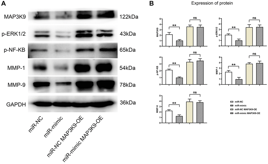 Overexpression of miR-361-5p inhibits the expression of MAP3K9, thus inhibiting the expression of MMPs in chondrocytes. (A) Protein band plots of MAP3K9, p-ERK1/2, p-NF-κB, MMP1 and MMP9. (B) Relative protein expression statistics of MAP3K9, p-ERK1/2, p-NF-κB, MMP1 and MMP9. N = 3; **P nsP > 0.05, miR-NC+MAP3K9 OE vs. miR-mimic+MAP3K9 OE.