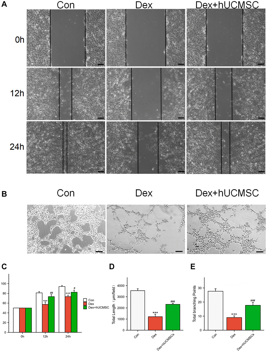 hUCMSCs improved the migration ability and angioplasty of Dex-treated BMECs. (A) Wound healing at 0, 12, and 24 h after Dex treatment. (B) Tube formation assay at 12 h after Dex treatment. (C) Scratch closure rate in three groups. (D, E) Total length and Total branching points in three groups. The data are presented as the means ± SD (n = 3). *p **p ***p #p ##p ###p 