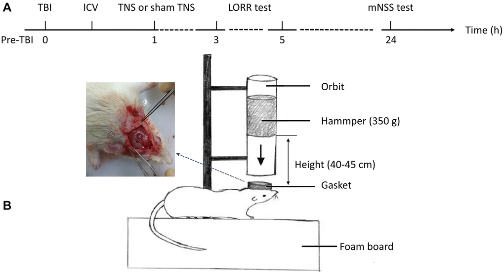 Experimental flow and a model of traumatic brain injury (TBI). (A) The schematic diagram depicted the intervention procedures and subsequent behavioral tests. (B) The construction of the TBI model was conducted in rats. Abbreviations: ICV: intracerebroventricular injection; TNS: trigeminal nerve electrical stimulation; LORR: loss of righting reflex; mNSS: modified neurological severity scale.