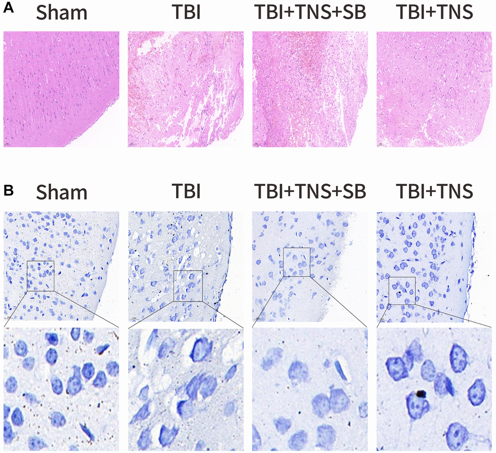 Trigeminal nerve electrical stimulation (TNS) relieves tissue damage and neuronal degeneration. (A) Representative hematoxylin-eosin staining images of four groups of cortical tissues showing areas of necrosis, scale = 50 μm. (B) Representative Nissl staining of four groups of cortical tissues demonstrates necrotic degeneration of neurons, scale = 20 μm.