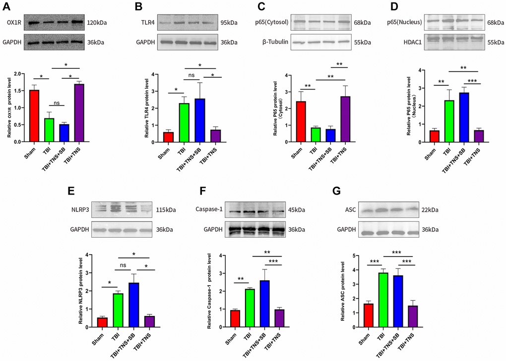 Trigeminal nerve electrical stimulation (TNS) inhibits toll-like receptor 4 (TLR4)/NF-κB (nuclear factor kappa B)/nucleotide-binding domain (NOD)-like receptor protein 3 (NLRP3) pathway after traumatic brain injury (TBI) via orexin-A (OX-A)/orexin receptor 1 (OX1R). (A) Protein levels of OX1R. (B) Protein levels of TLR4. (C) NF-κB (p65) protein level in the cytosol. (D) NF-κB (p65) protein level in the nucleus. (E) Protein levels of NLRP3. (F) Protein levels of caspase-1. (G) Protein levels of apoptosis-associated speck-like protein (ASC). Results are expressed as mean ± standard deviation (SD; *P **P ***P 