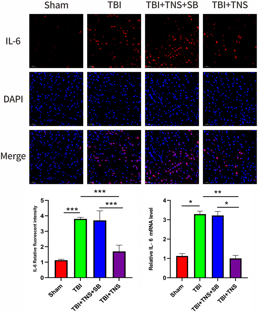 Trigeminal nerve electrical stimulation (TNS) decreases interleukin (IL)-6 levels after traumatic brain injury (TBI) via orexin-A (OX-A)/orexin receptor 1 (OX1R). Representative immunofluorescence staining and relative mRNA levels of interleukin IL-6. Results are expressed as mean ± standard deviation (SD; *P **P ***P 