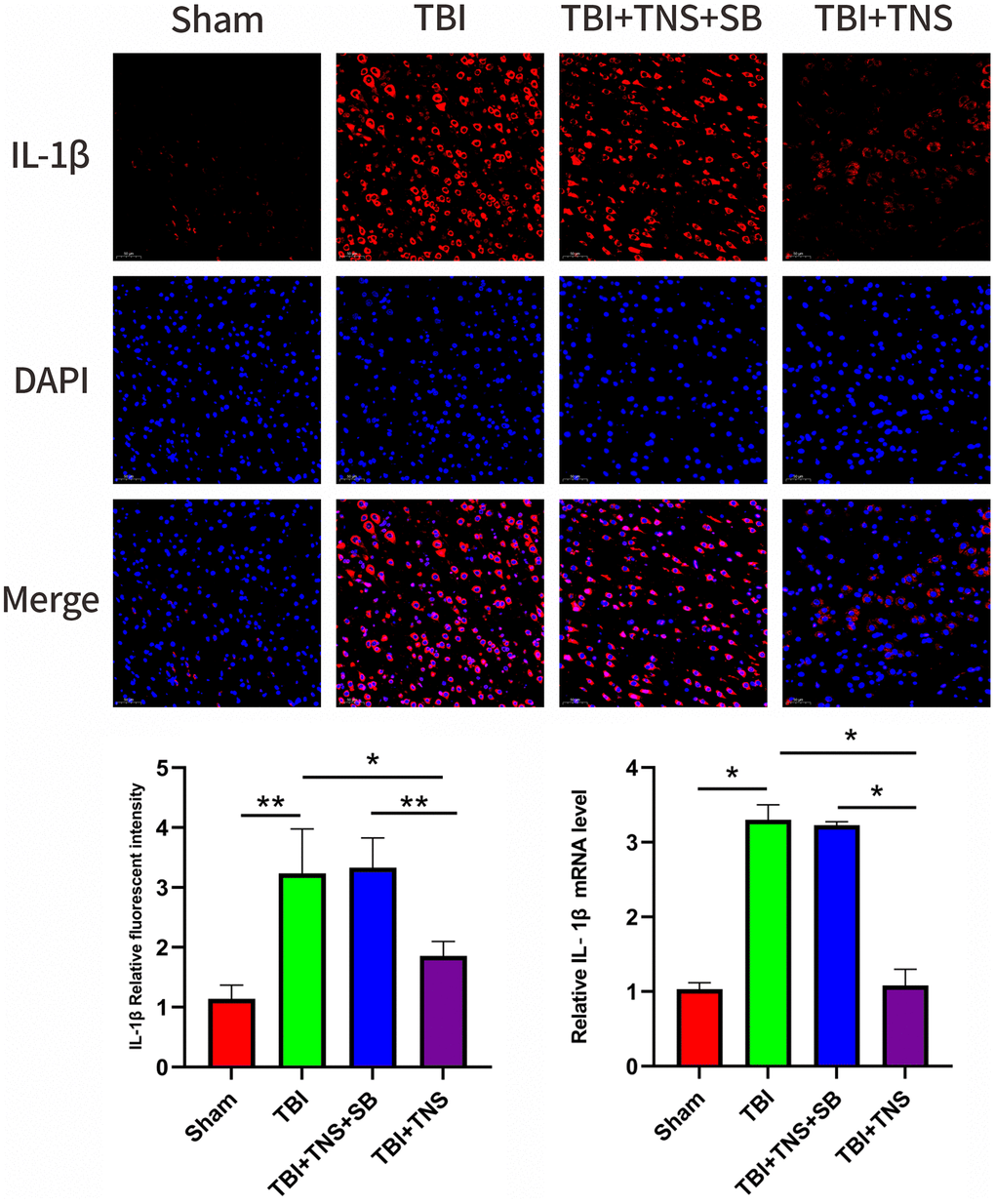 Trigeminal nerve electrical stimulation (TNS) decreases interleukin (IL)-1β levels after traumatic brain injury (TBI) via orexin-A (OX-A)/orexin receptor 1 (OX1R). Representative immunofluorescence staining and relative mRNA levels of IL-1β. Results are expressed as mean ± standard deviation (SD; *P **P ***P 