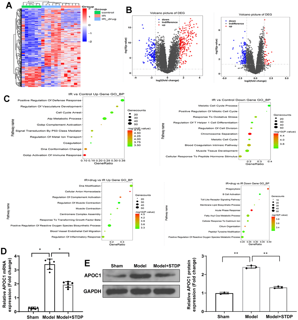 STDP regulates APOC1 expression in the myocardial tissues of CME rat models. Note: (A) Gene expression levels are shown in a heat map, in which each row represents a gene and each column represents a sample of hip joint capsule tissue. The variation in color of red to blue indicates the signal level, with red indicating high signal or upregulation, blue indicating low signal or downregulation. (B) The distribution of differential expressed genes is showed by volcano map. (C) GO analysis on the differential expressed genes. (D) qRT-PCR detected the APOC1 expression in myocardial tissues. (E) Western blot detected the APOC1 protein expression in myocardial tissues. *P 