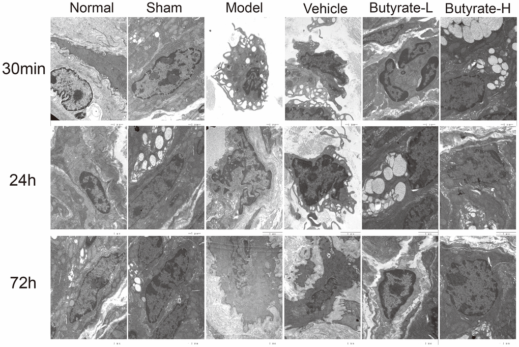 The results of transmission electron microscopy of intestinal tissue.