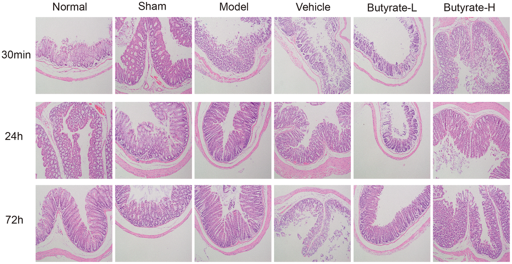 Hematoxylin and eosin staining in this study.