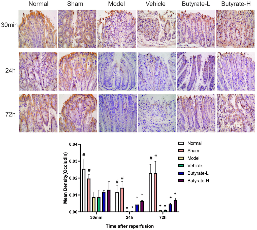 The immunohistochemical analysis of Occludin. It represents a group that differs significantly from the vehicle group with the symbol (#). It represents a group that differs significantly from the vehicle group with the symbol (*).