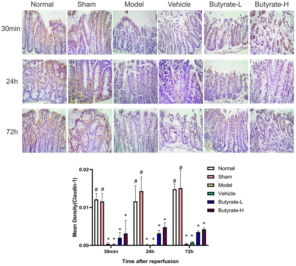 The immunohistochemical analysis of Claudin-1. It represents a group that differs significantly from the vehicle group with the symbol (#). It represents a group that differs significantly from the vehicle group with the symbol (*).