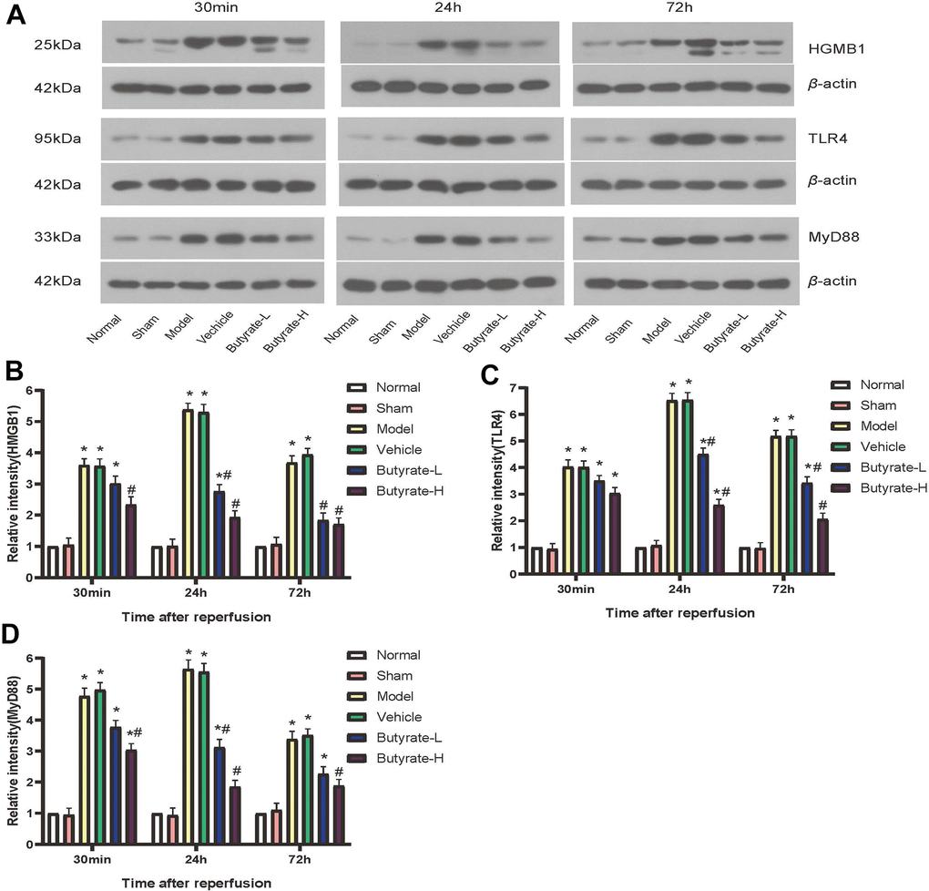 Butyrate may protect against IRI via the HMGB1-TLR4-MyD88 signaling pathway. (A) Western blotting results of three proteins in different groups. (B) Comparison of Western blotting results of HMGB1 in different groups. (C) Comparison of Western blotting results of TLR4 in different groups. (D) Comparison of Western blotting results of MyD88 in different groups. It represents a group that differs significantly from the vehicle group with the symbol (#). It represents a group that differs significantly from the vehicle group with the symbol (*).