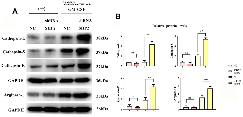 Inhibition of SHP2 in TAM can promote the stimulation of cathepsin and M2 polarization by lung adenocarcinoma. (A) Protein band diagram of Cathepsin-L, Cathepsin-S, Cathepsin-K and Arginase-1; (B) Relative protein expression statistics of Cathepsin-L, Cathepsin-S, Cathepsin-K and Arginase-1. N=3; **P0.05.