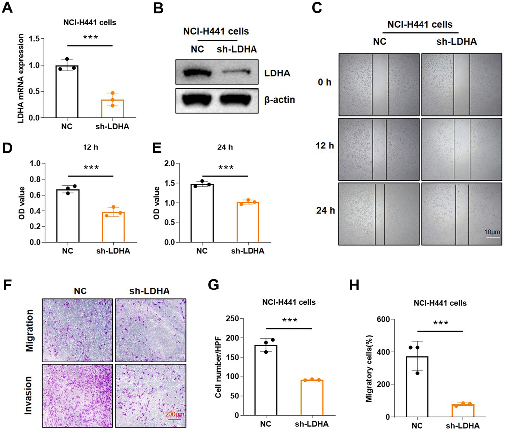 Knockdown of LDHA inhibited proliferation and migration of LUAD. (A, B) Knockdown of LDHA was verified by RT-qPCR and western blot in NCI-H441 cells. (C) Microscopic observations were recorded at 0, 12, and 24 h after scratching the surface of a confluent layer of the indicated NCI-H441 cells. (D, E) MTT assay suggested that knockdown of LDHA inhibited the proliferation of NCI-H441 cells. (F) The effects of LDHA on cell migration and invasion were examined by transwell assays in NCI-H441 cells. (G) Quantitative analysis of cell migration in NCI-H441 cells. (H) Quantitative analysis of cell invasion in NCI-H441 cells. *p 