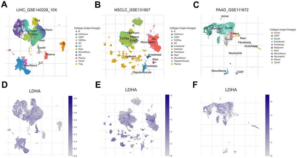 LDHA expression at the single-cell level. (A–C) UMAP plots showing cell clusters in different cell types of multiple cancers, including LIHC, NSCLC, and PAAD. (D–F) The expression levels of LDHA in different cell types in different types of human cancers, including LIHC, NSCLC, and PAAD.